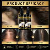 Black Rice Water Spray For Hair Root Strengthening & Growth (Pack Of 2)